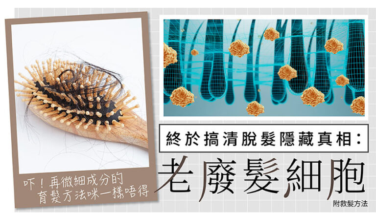 終於搞清脫髮隱藏真相：老廢髮細胞 優惠 (promo)