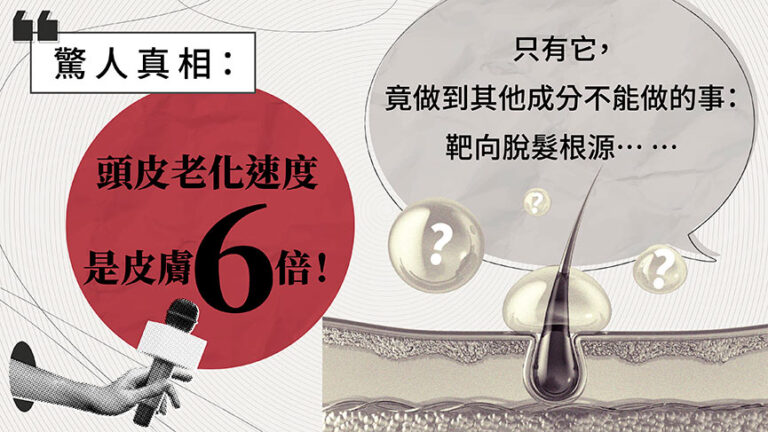 驚人真相：頭皮老化速度是皮膚6倍！ 優惠 (promo)